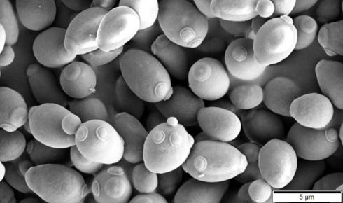 Saccharomyces cerevisiae SEM resize