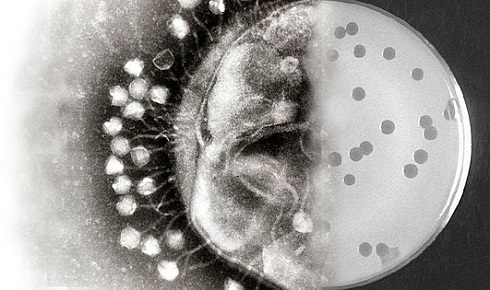 Resized Bacteriophages GrahamBeards DeborahJacobsSerum GrahamHatfull