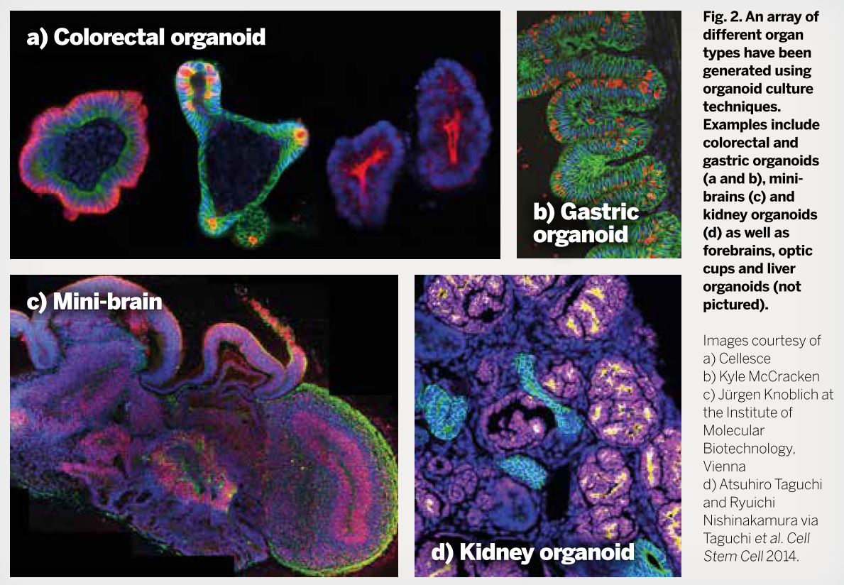 Organoid figure