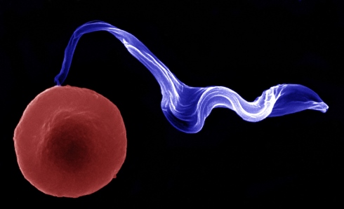 Trypanosome-with-Ec